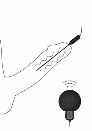 Silicone Rechargeable Vibrating Plug Remote Controlled - Urethra - Afbeelding 7